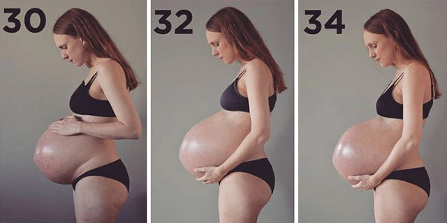Mang thai 3 hiếm gặp chúng ta phải gọi người mẹ này là siêu nhân