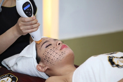 phù thủy laser xứ ý hé lộ công nghệ trẻ hóa da hiện đại của thế giới