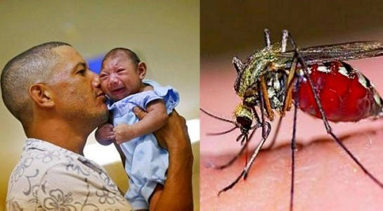 Thêm bằng chứng virus zika liên quan bất thường não thai nhi