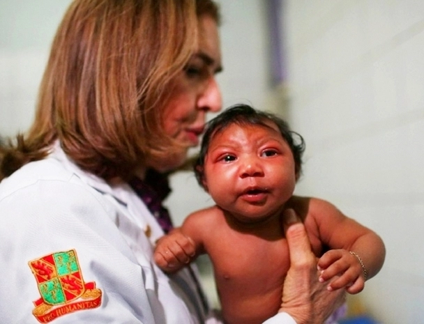 Thêm bằng chứng virus zika liên quan bất thường não thai nhi