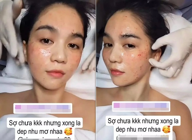 Từng tự tin có gương mặt mang vẻ đẹp quê trẻ lâu ngọc trinh nay thừa nhận phải đi chích nhẹ khi cần