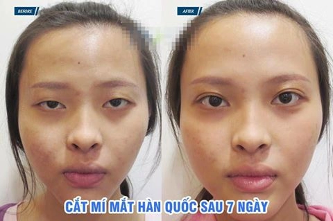 Bị đồn lên đời nhờ dao kéo tú hảo the face tung ảnh thuở bé phủ nhận tin đồn