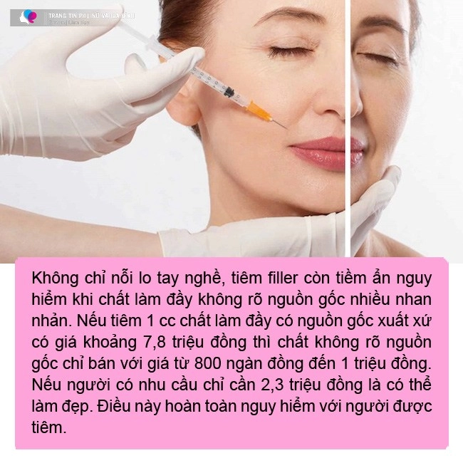 Cuối năm chị em đổ xô tiêm chất làm đầy tăng đột biến chuyên gia nhắn nhủ một điều