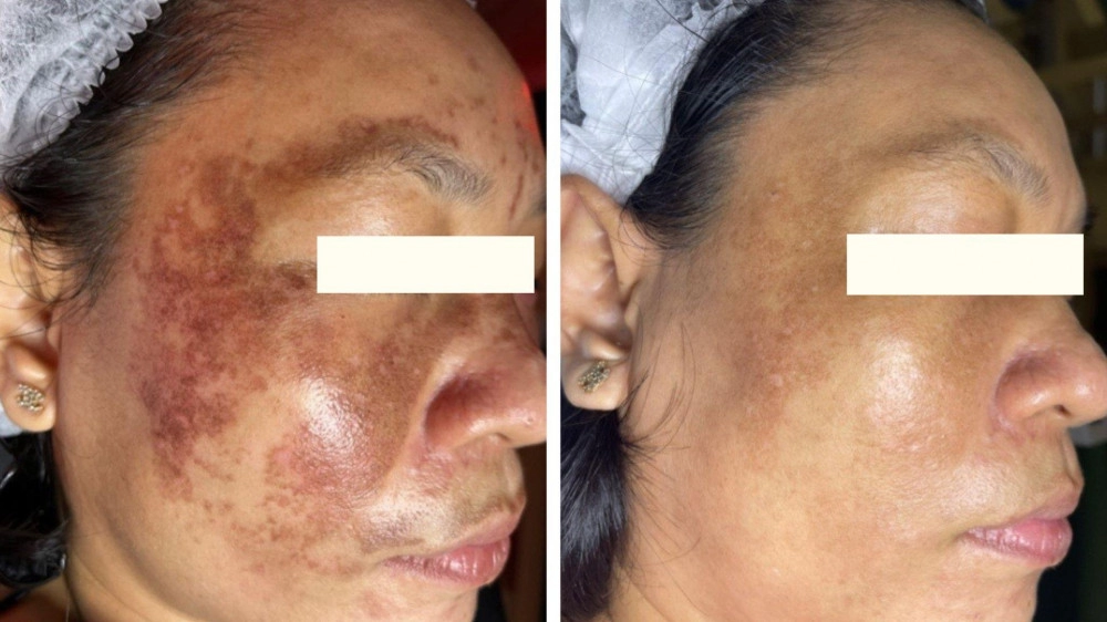 Drh clinic - khẳng định vị thế trong ngành làm đẹp