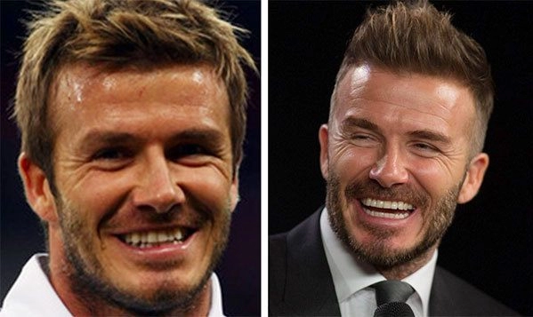 Là soái ca sân cỏ cristiano ronaldo - david beckham cũng sửa sang vung gần nửa tỷ để thăng hạng nhan sắc