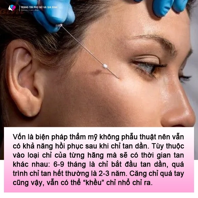 lạnh gáy những pha cấy chỉ căng da của chị em trung niên đẹp chưa thấy ngắm đã xót