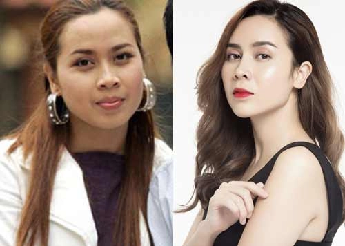 Loạt mẹ bỉm sữa của showbiz việt vốn đã xinh đẹp nhưng vẫn kiên trì dao kéo đến cùng