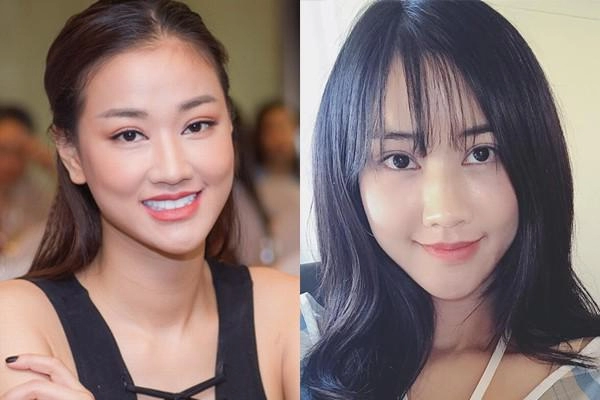 Loạt mẹ bỉm sữa của showbiz việt vốn đã xinh đẹp nhưng vẫn kiên trì dao kéo đến cùng