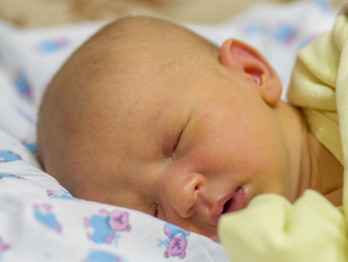 Trẻ sơ sinh bị vàng da vàng mắt và những điều cần biết