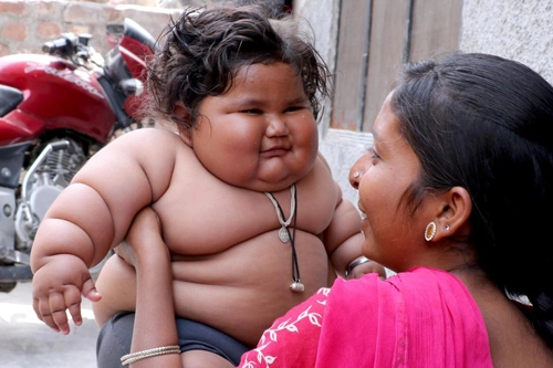 Ăn gấp 4 lần bình thường bé gái nặng 17kg khi mới 8 tháng tuổi