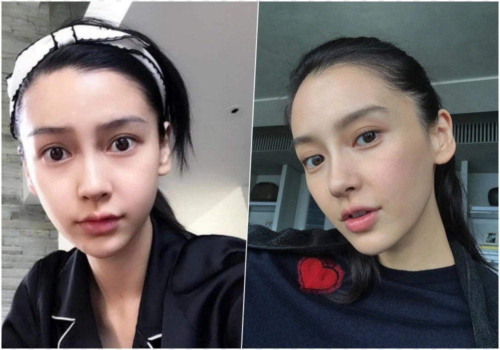 Angelababy thời thanh xuân mặt tròn phúng phính giờ u35 gầy nhom lộ cả rổ khuyết điểm