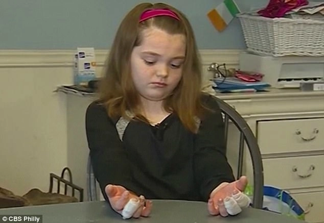 Cảnh báo bé gái 11 tuổi bị bỏng nặng ở tay do tiếp xúc với hàn the