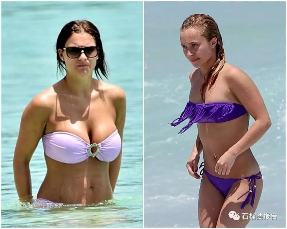 Quên bikini đi đây mới là kiểu áo tắm hot nhất hè này dành cho mọi vóc dáng