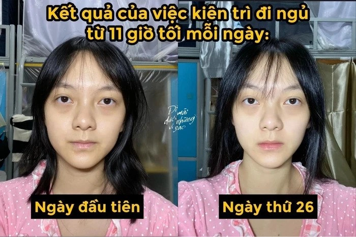 Cô gái có màn thay đổi làn da ngoạn mục nhờ đi ngủ