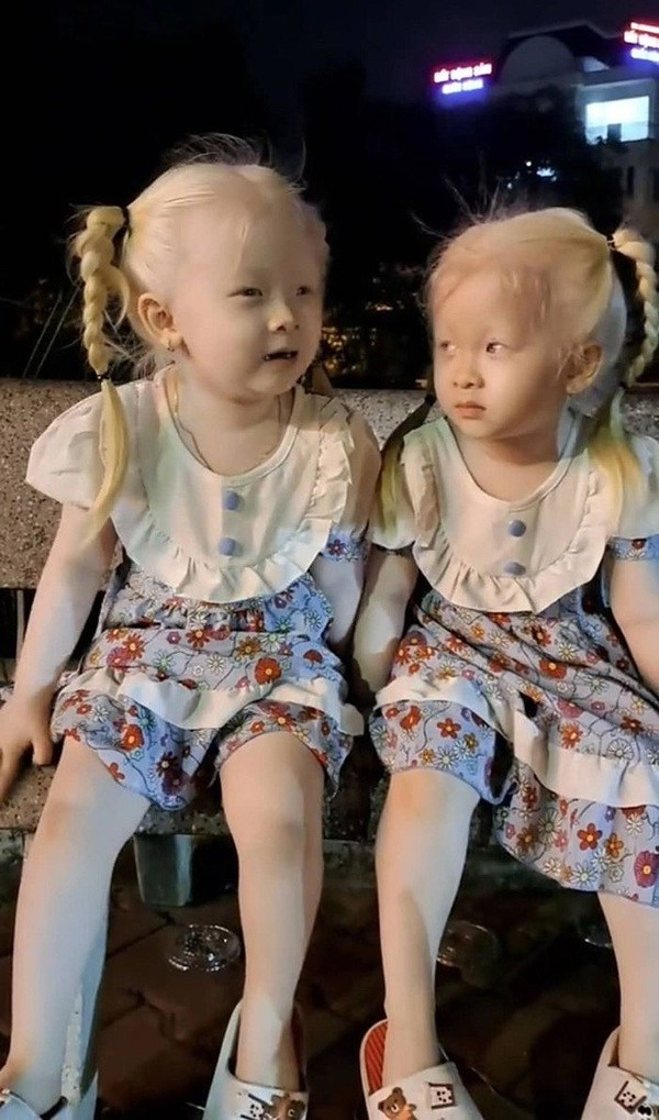 Hai bé gái song sinh bạch tạng ở sóc trăng giờ giúp bố mẹ đổi đời mỗi tháng làm video kiếm vài chục triệu khai trương cháy hàng