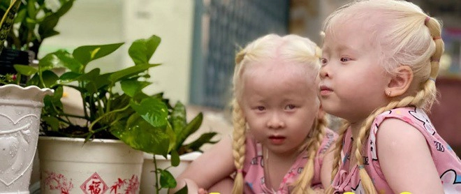 Hai bé gái song sinh bạch tạng ở sóc trăng giờ giúp bố mẹ đổi đời mỗi tháng làm video kiếm vài chục triệu khai trương cháy hàng