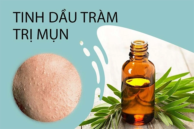 15 cách trị mụn thịt tận gốc tại nhà hiệu quả nhất hiện nay