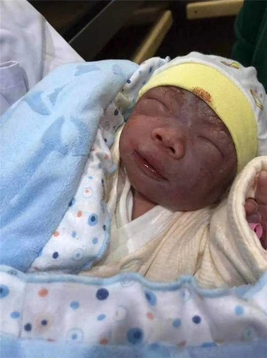 Bé sơ sinh chào đời bị gia đình chối bỏ vì quá xấu 1 tháng sau lột xác nhận không ra