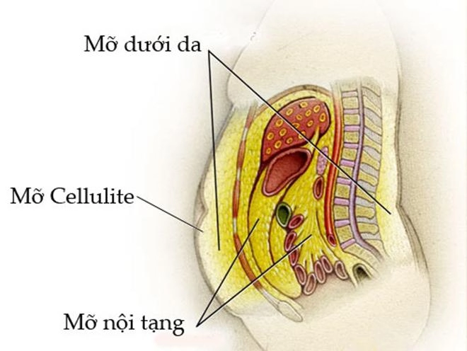 Cận cảnh một ca hút mỡ bụng khiến người phụ nữ cứng rắn nhất cũng phải bật khóc