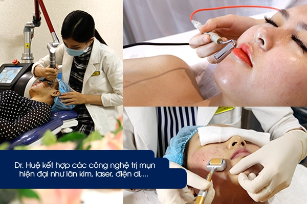 Dr huệ - địa chỉ thẩm mỹ viện và spa trị mụn uy tín tại thành phố hồ chí minh