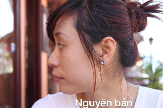 Mỹ nhân hà thành tiết lộ câu chuyện 15 năm phẫu thuật thẩm mỹ để xứng đôi với ông xã