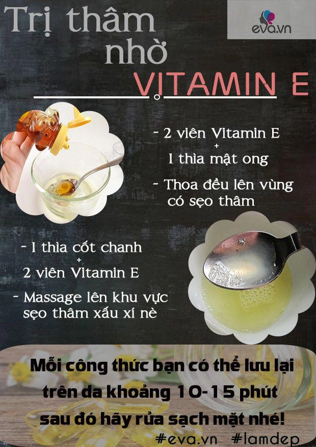 Nằm lòng 4 cách trị sẹo thâm lâu năm tiết kiệm và hiệu quả 100