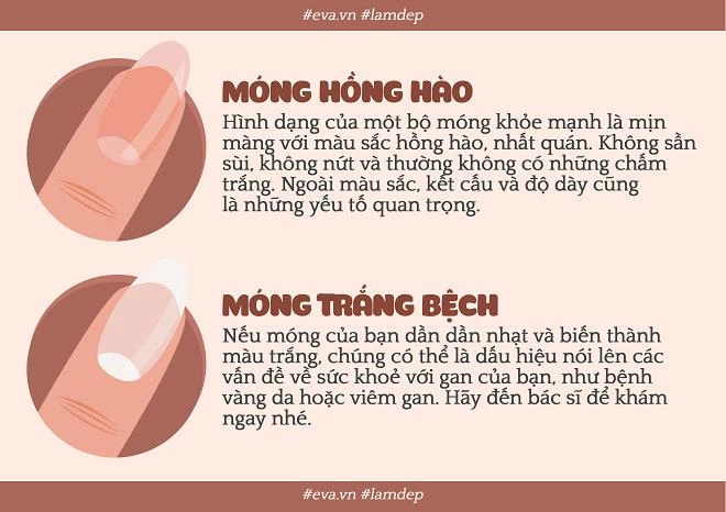 Nếu bộ móng của bạn bỗng trở nên xấu xí thì đều có lý do cả đấy