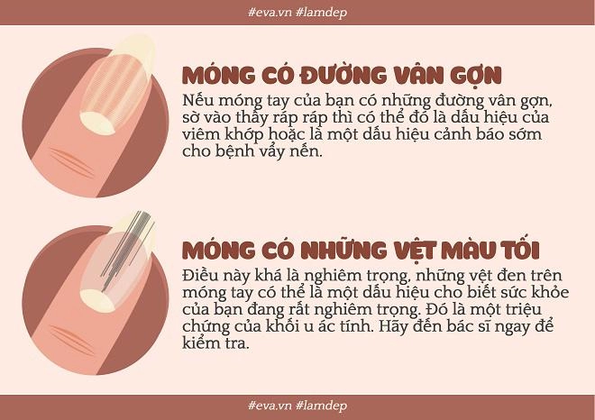 Nếu bộ móng của bạn bỗng trở nên xấu xí thì đều có lý do cả đấy