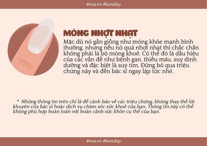 Nếu bộ móng của bạn bỗng trở nên xấu xí thì đều có lý do cả đấy