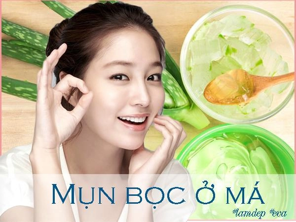 Ngày nào cũng làm theo mụn bọc ở má nặng cỡ nào cũng bị xóa mờ cực nhanh