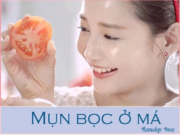 Ngày nào cũng làm theo mụn bọc ở má nặng cỡ nào cũng bị xóa mờ cực nhanh