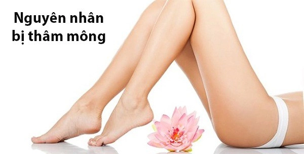 Những cách trị thâm mông an toàn hiệu quả nhanh nhất tại nhà