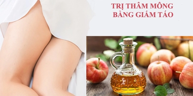 Những cách trị thâm mông an toàn hiệu quả nhanh nhất tại nhà