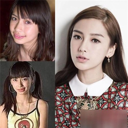 Angelababy đang chịu hậu quả của thẩm mỹ