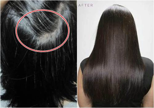 3 cách trị tóc rụng nhiều và bạc sớm với công thức từ khế chua
