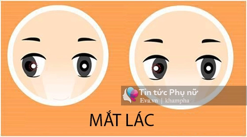 Cách kiểm tra mắt trẻ sơ sinh bị lác mẹ nào cũng cần biết