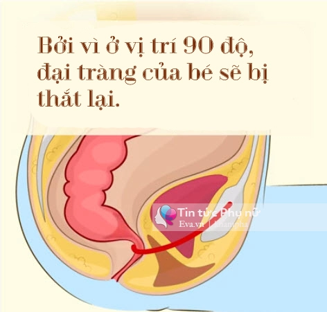 Chỉ vì chiếc bồn cầu con có nguy cơ bị ung thư đại tràng