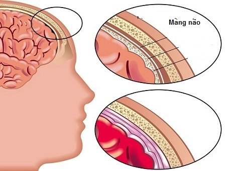 Người mẹ này đã chịu 16 lần sảy thai cuối cùng vẫn mất con 15 tháng vì căn bệnh ít ai ngờ