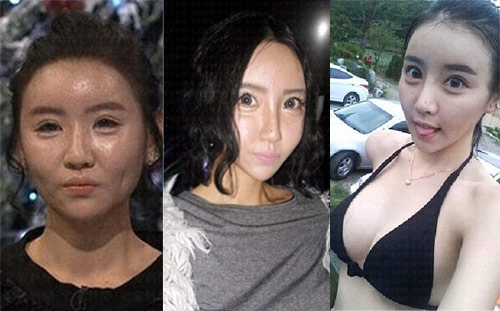 Những kỷ lục dao kéo ở cường quốc phẫu thuật thẩm mỹ