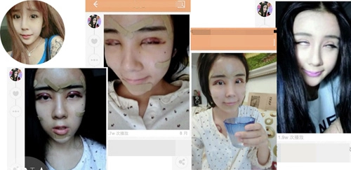 8 màn dao kéo khiến mọi người lạnh sống lưng
