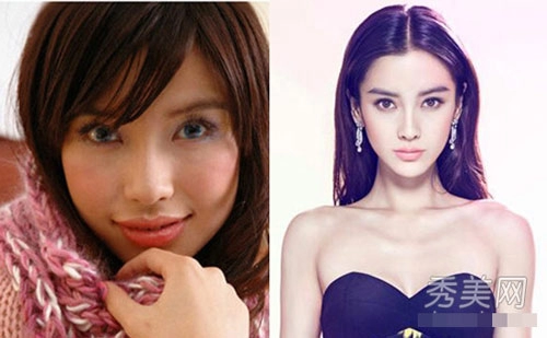 Angelababy đổi đời nhờ dao kéo