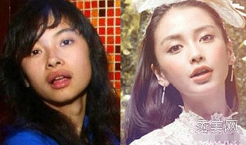 Angelababy đổi đời nhờ dao kéo