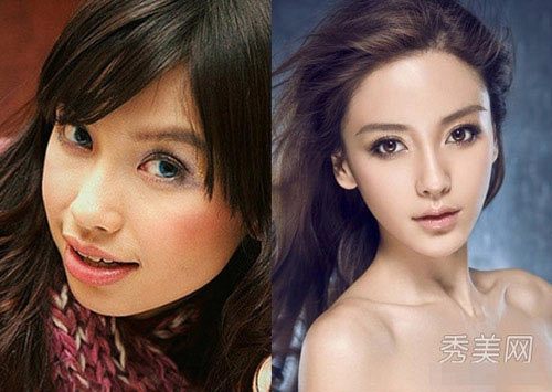 Angelababy đổi đời nhờ dao kéo