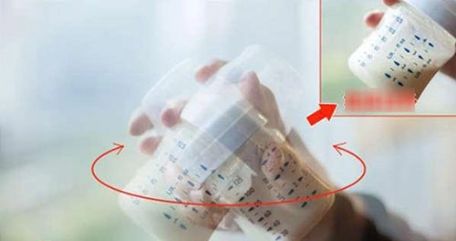 Bé 2 tuổi đã sỏi thận bác sĩ sau khi khám mắng bố mẹ té tát vì lỗi pha sữa sai lầm