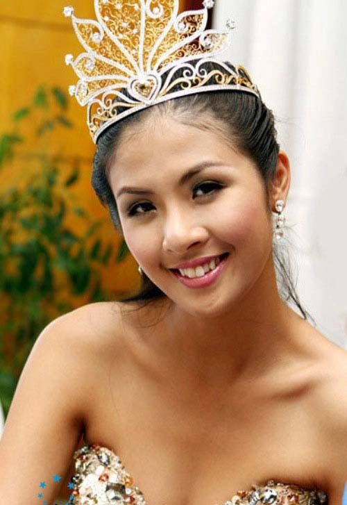 Hàm răng kém đẹp của mỹ nhân việt