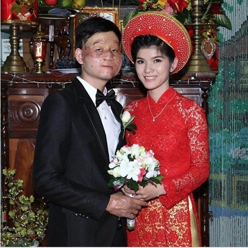 Lỗi của chân dài