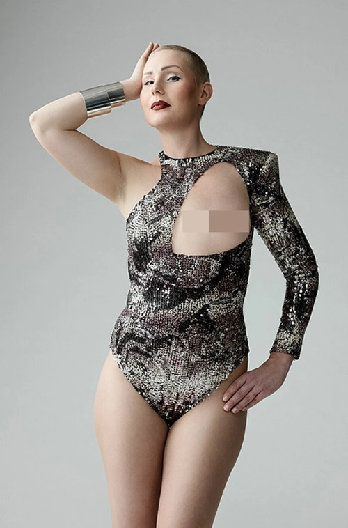 Ngỡ ngàng trước ảnh bikini của phụ nữ bị ung thư vú