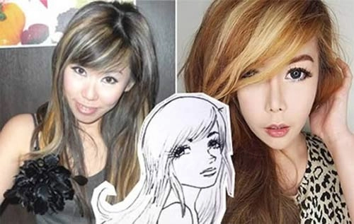 Những ca phẫu thuật quái đản bậc nhất thế giới