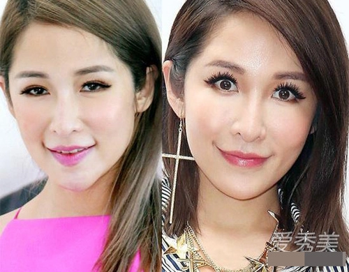 Những di chứng thẩm mỹ đáng sợ của mỹ nhân