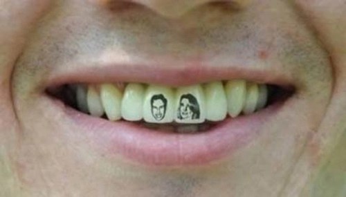 Xăm răng cho nụ cười cá tính